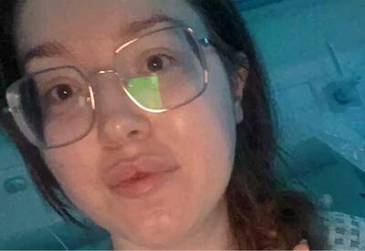 Женщина после свадьбы проснулась без зрения из-за редкого диагноза