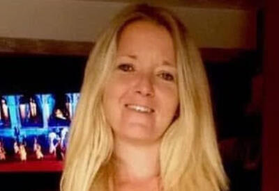 Женщина потеряла способность открывать рот из-за артрита челюсти