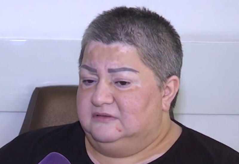 İzzətin verilişinə dəvət alan Xalq artistinin başına