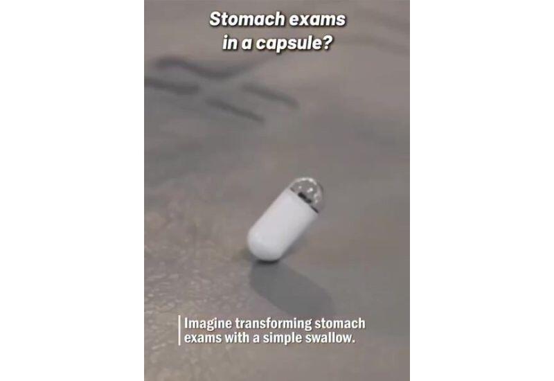 В Китае создали капсулу-робота для безболезненной гастроскопии