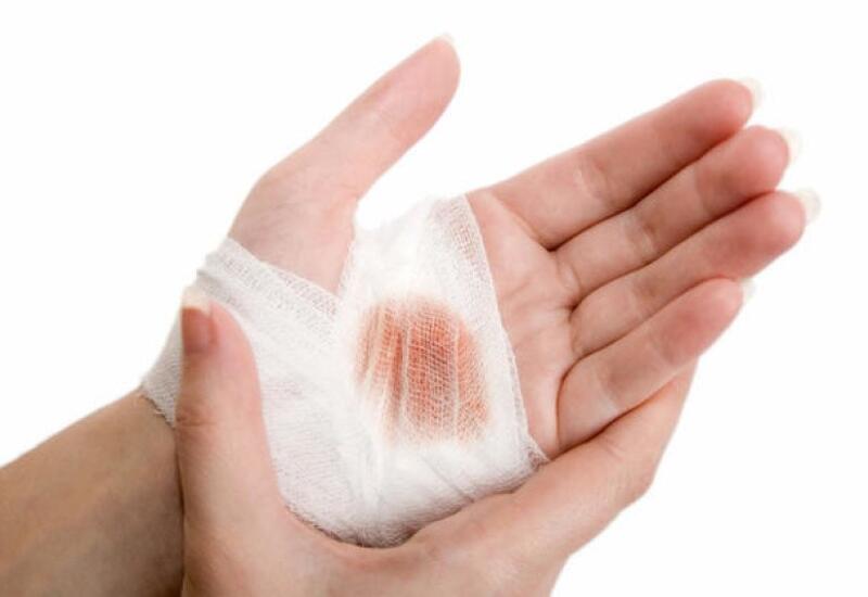 Раскрыт неожиданный фактор медленного заживления ран