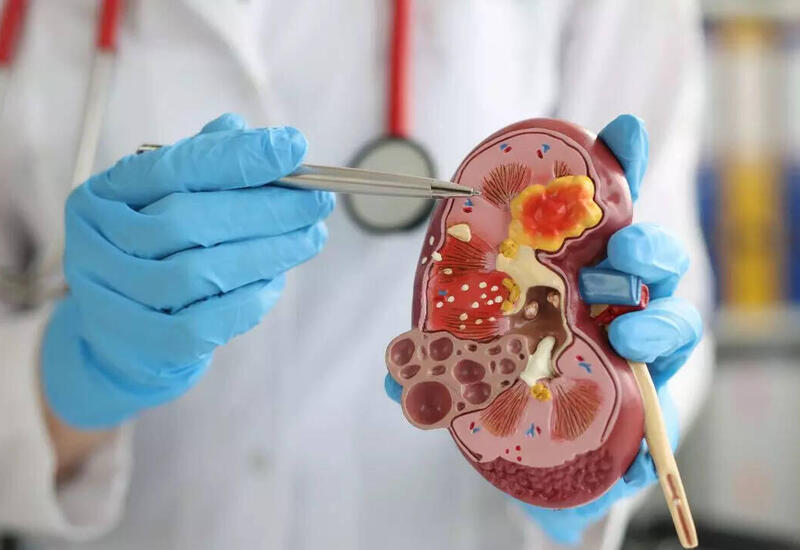 Səhər vərdişləri böyrəklərinizi məhv edə bilər