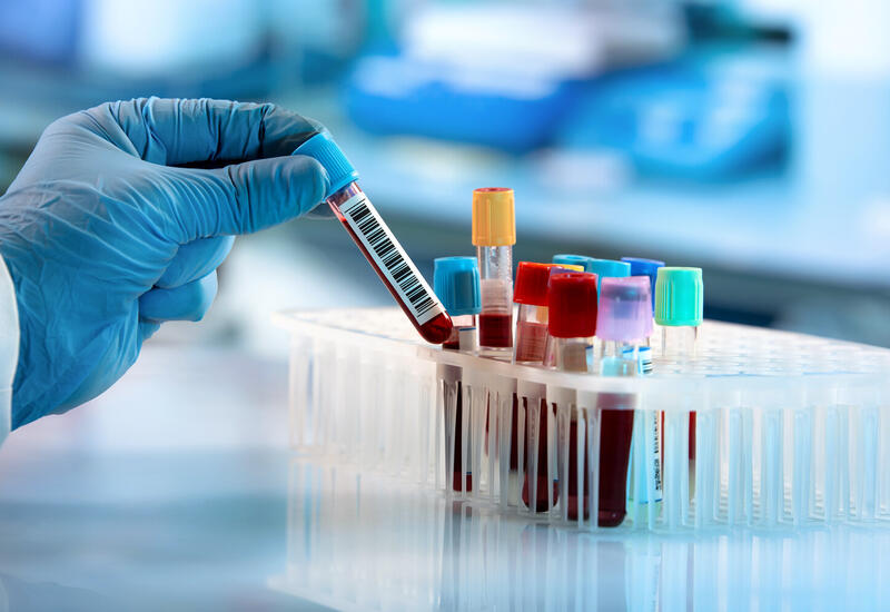 Ученые разработали анализ крови на психические заболевания