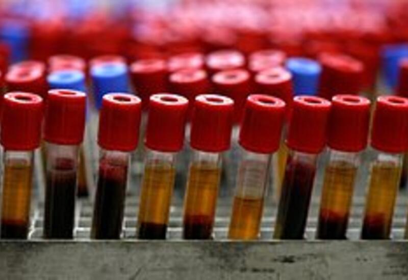 Найден способ точно предсказать риск ранней смерти