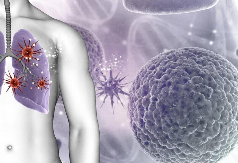 Azı gündə 3 dəfə yeyirik