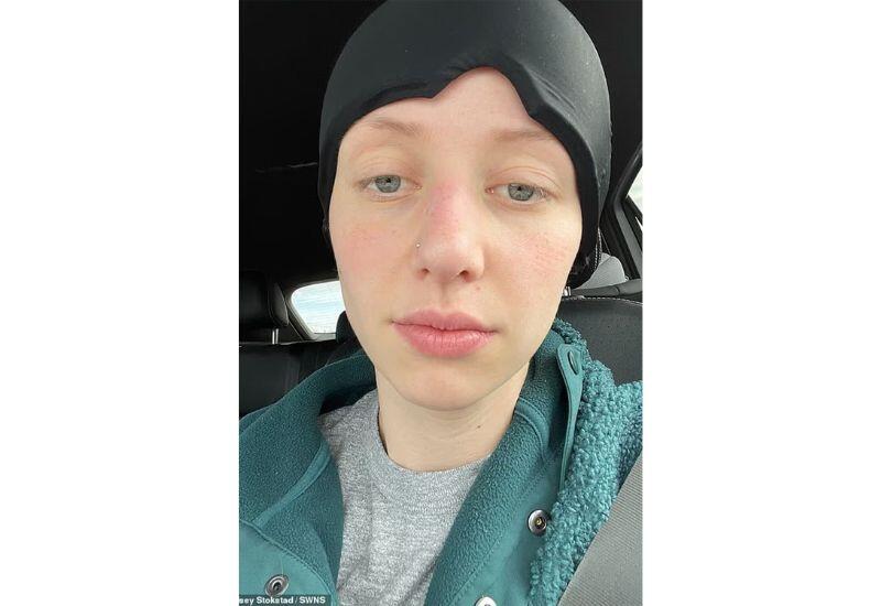 У 32-летней женщины с покалыванием в руке нашли рак мозга