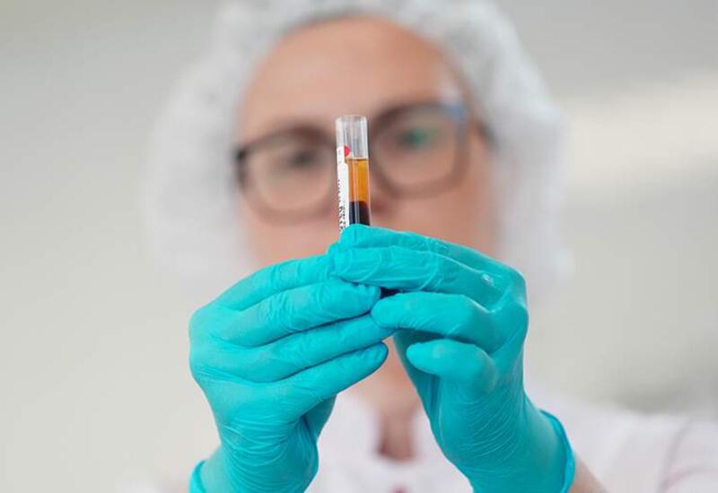 Эксперт рассказал о проявлениях ВИЧ