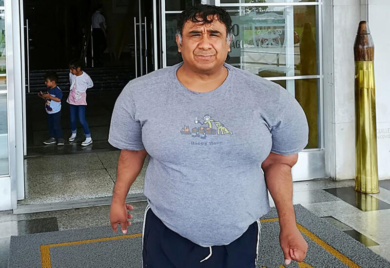 Тело мужчины распухло из-за инцидента во время дайвинга