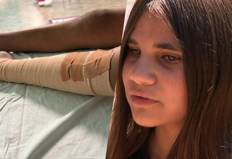 11-летняя девочка пережила укус одной из самых ядовитых змей в мире