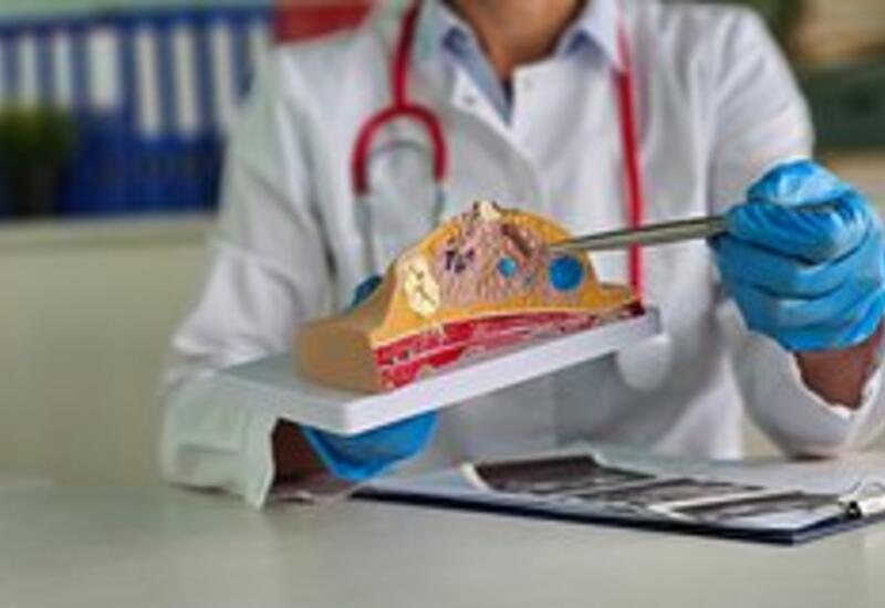 Онколог предупредил о риске рецидива рака груди