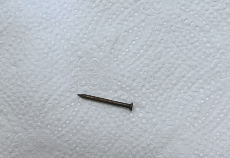 В Баку из желудка ребенка извлекли гвоздь