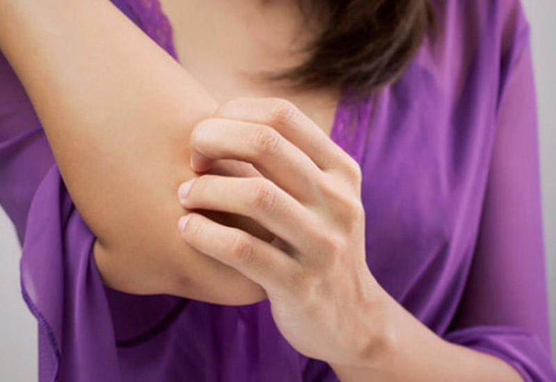 Dəri niyə qaşınır?