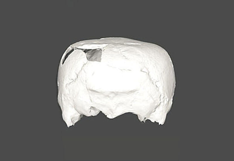 Археологи нашли 1400-летний череп, удививший их своей формой