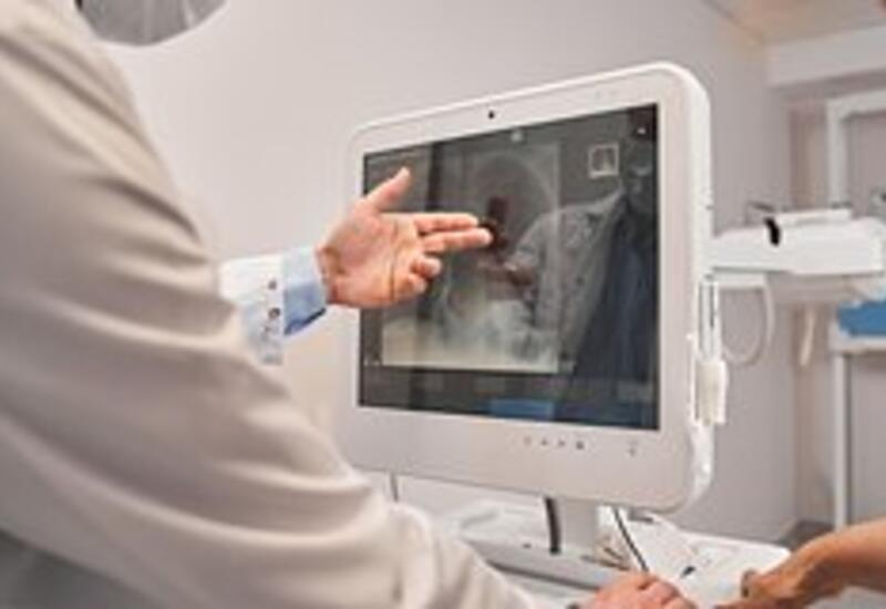 Стал известен неочевидный способ выявления сердечно-сосудистых рисков