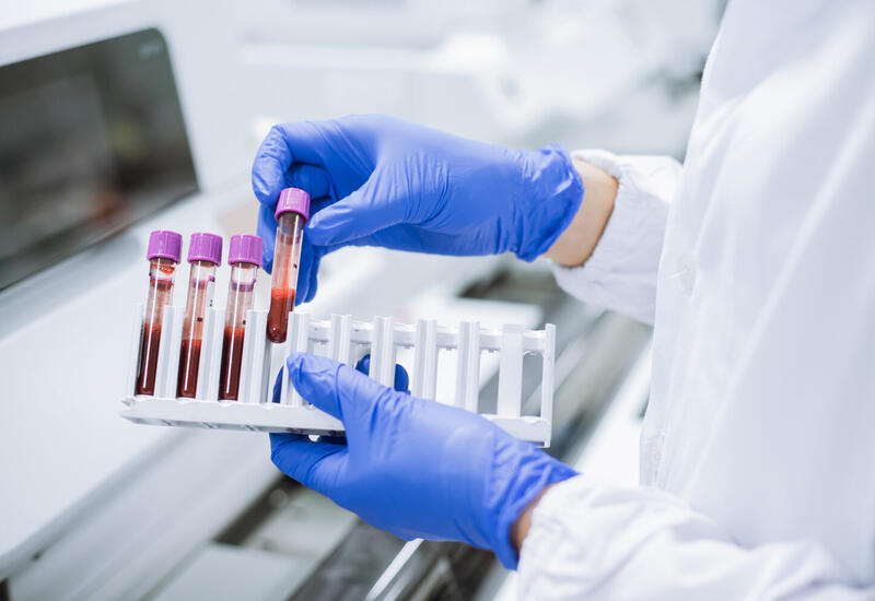 Ученые нашли новые биохимические признаки старения в крови