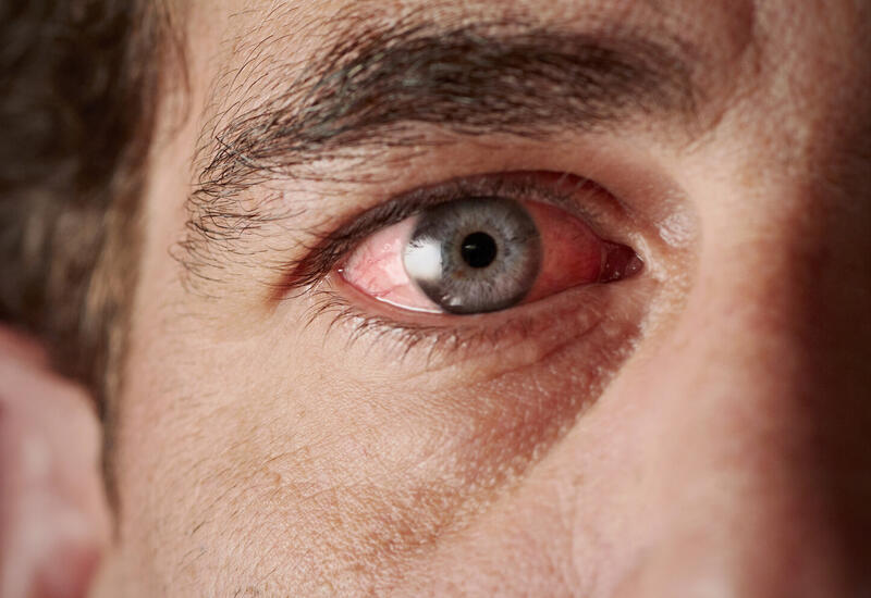 Найден способ определить скорость старения по сосудам в глазах