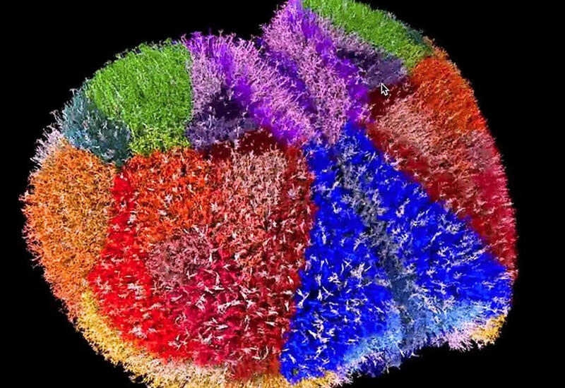 "Мозгоподобные" компьютеры оказались сильны в сложных уравнениях