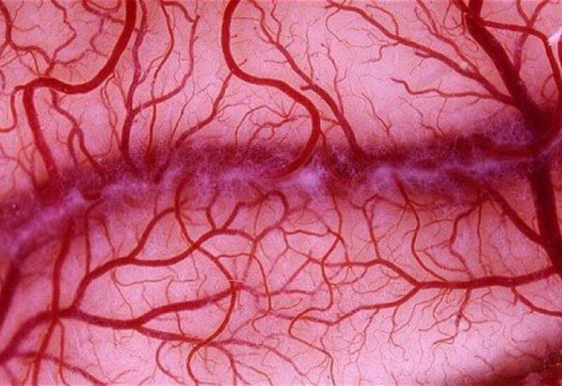 Найден новый маркер риска инфаркта и инсульта