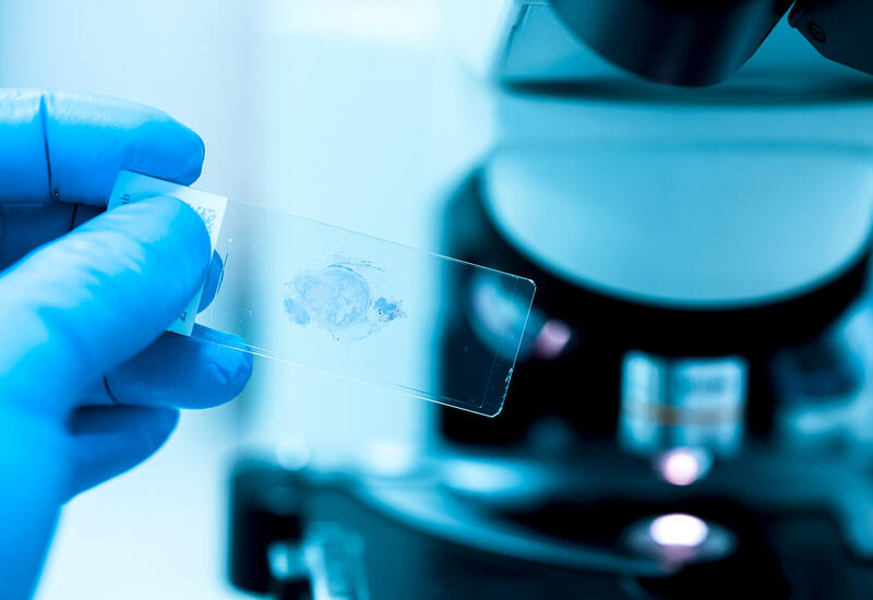 Найден способ ускорить гибель раковых клеток