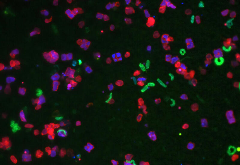 Ученые предложили использовать «микробные города» для защиты здоровья в космосе