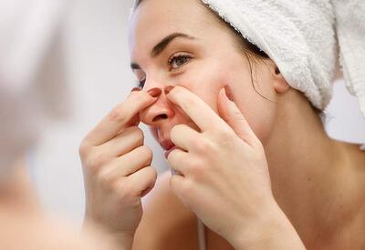 Косметолог предупредила об инфекциях при самостоятельном выдавливании прыщей