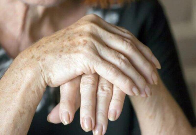 Əllərin dərisini necə cavanlaşdırmaq olar?