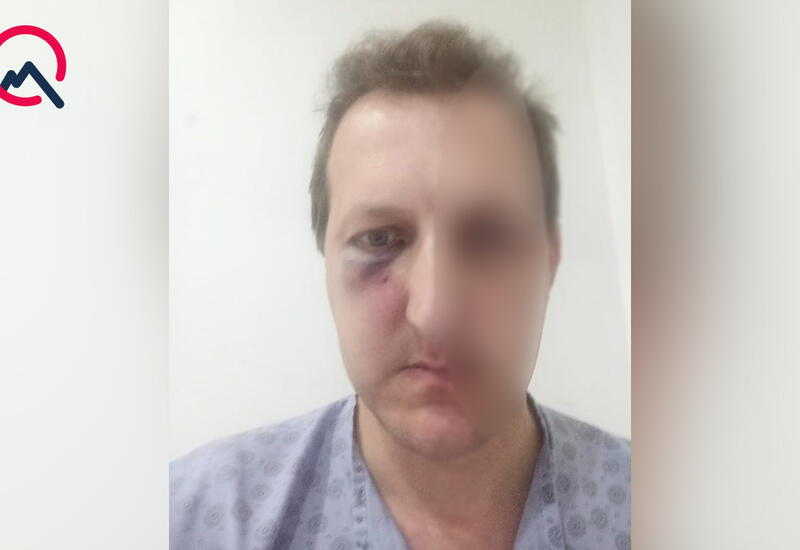 Bakıda Xalq artistinin oğlunu döydülər