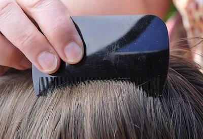 Трихолог назвала главные ошибки в уходе за волосами