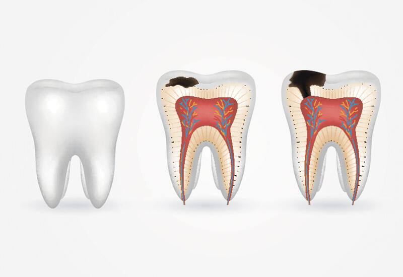 Назван неочевидный провокатор деменции и инсульта