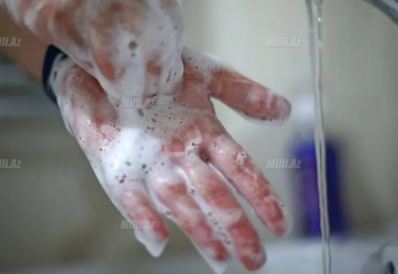 Elm əl gigiyenasında hansını tövsiyə edir