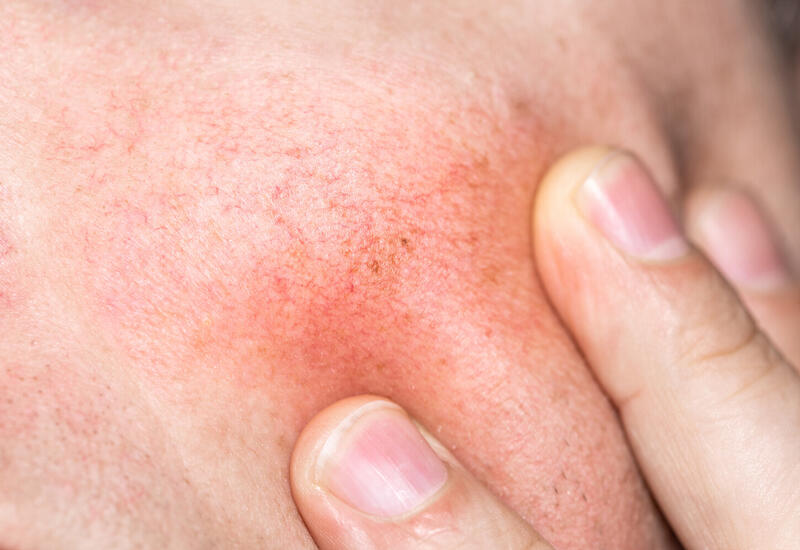 Врач объяснил, как остановить уменьшение сети капилляров с возрастом