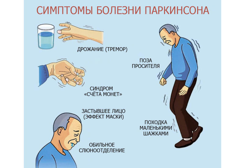 Названы ранние признаки болезни Паркинсона