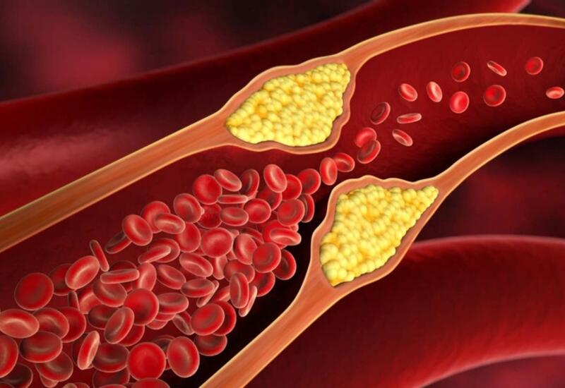 Ученые научились управлять активностью холестерина с помощью света