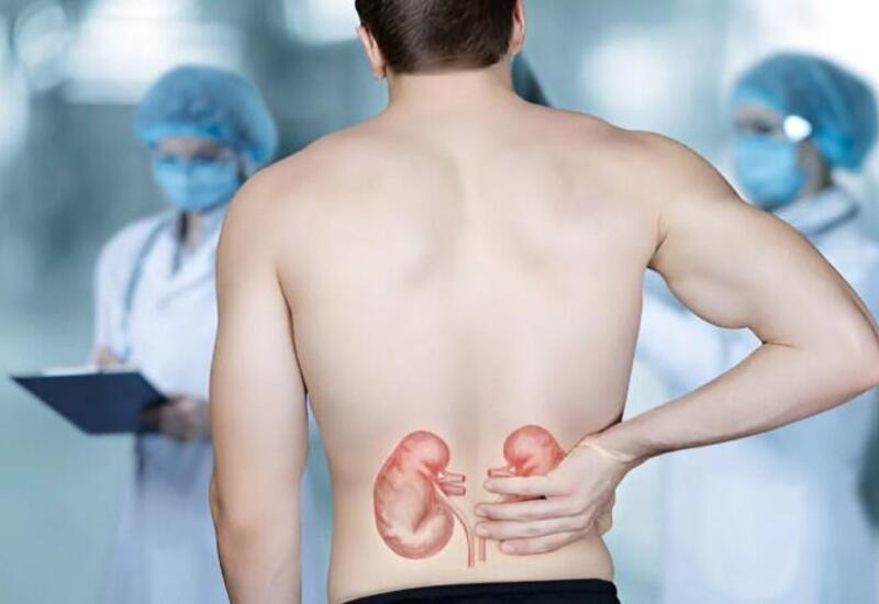 Bu qidalar böyrək daşı yaradır