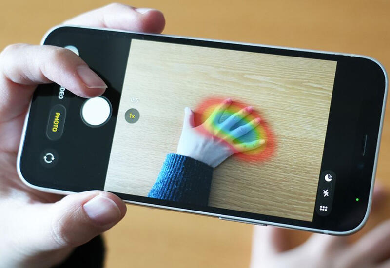 Фотография может помочь выявить опасное гормональное заболевание