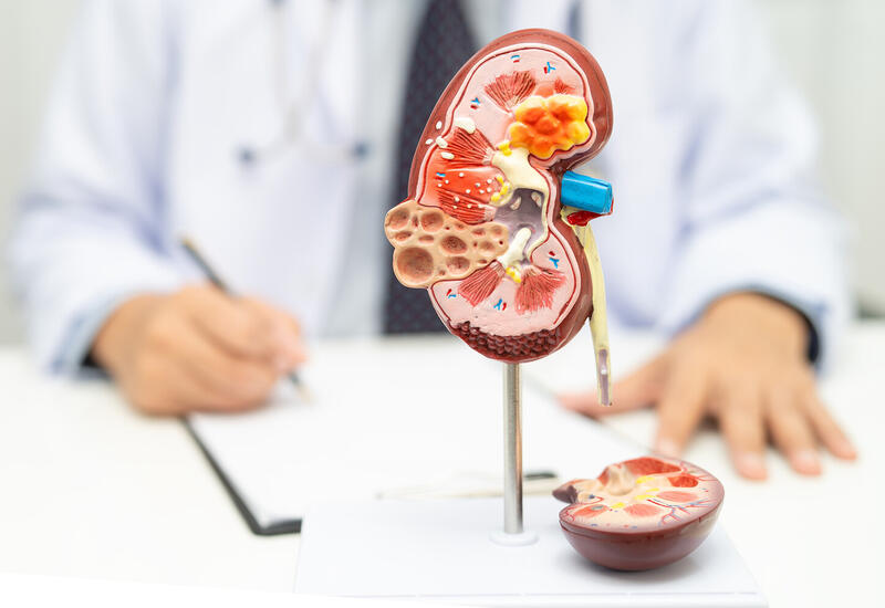 Какие лекарства приводят к развитию патологии почек