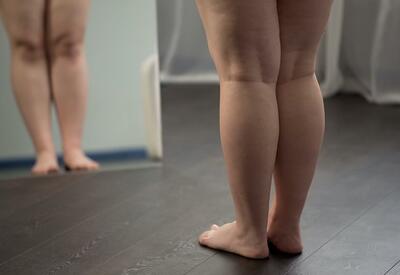 Названы неочевидные факторы риска преждевременной смерти женщин