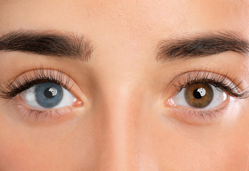 Почему у некоторых людей глаза разного цвета?