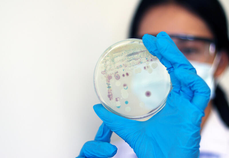 Ученые выяснили, какой грибок переживет путешествие на Марс