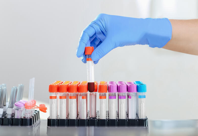 Создан тест для диагностики рака по одной капле крови