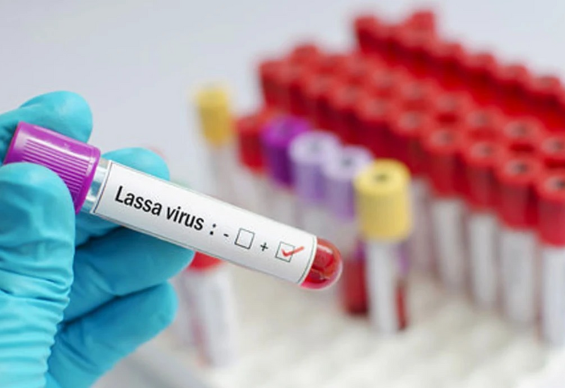 Lassa: Yeni virus yayıldı, əlamətləri bunlardır