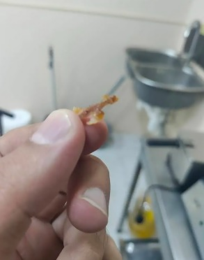 Toyuq dönərlərində yad cisimlər aşkarlanır
