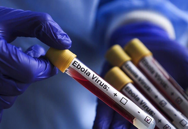 Nigeriyada aşkar edilən Ebola virusu Keniyadakı ştamla genetik bağlıdır
