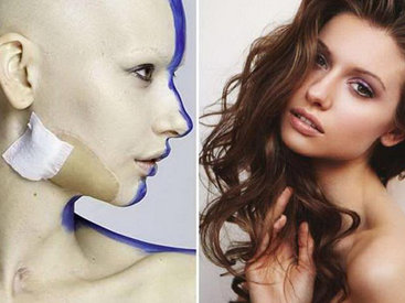 Невероятные фотографии модели, потерявшей челюсть из-за рака - ФОТО