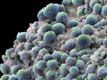 Азербайджанские ученые изобрели лекарство от рака