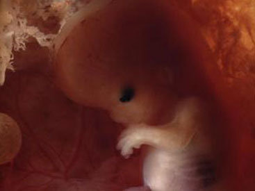 Армения побила рекорд по селективным абортам