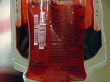 Сколько стоит кровь в Азербайджане? - ОПРОС