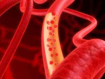 Обнаружен скрытый разрушитель здоровья сосудов