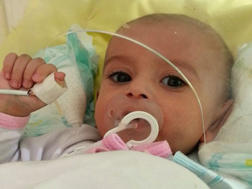 Деньги для лечения маленького Кямала Джафарова собраны