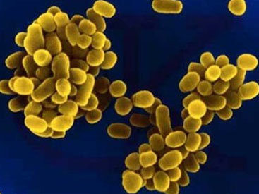 В Армении вновь разбушевался бруцеллез